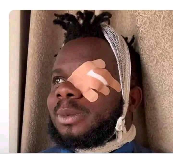 Ara agbaala eyewitness 😁