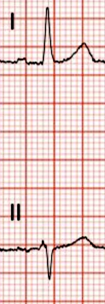 Brooks Walsh tweet media