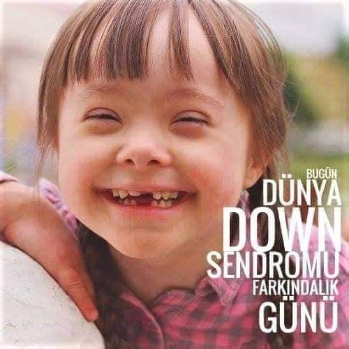 Evet  bizler farklıyız. 
Ama sizin düşündüğünüz gibi değil. 
Farklıyız çünkü yargılamayız. 
Farklıyız çünkü içimizde kötülük yoktur. 
Bu yüzden ben down sendromumla gurur duyuyorum..

GÜZEL YÜZLÜ YERYÜZÜ MELEKLER♥️