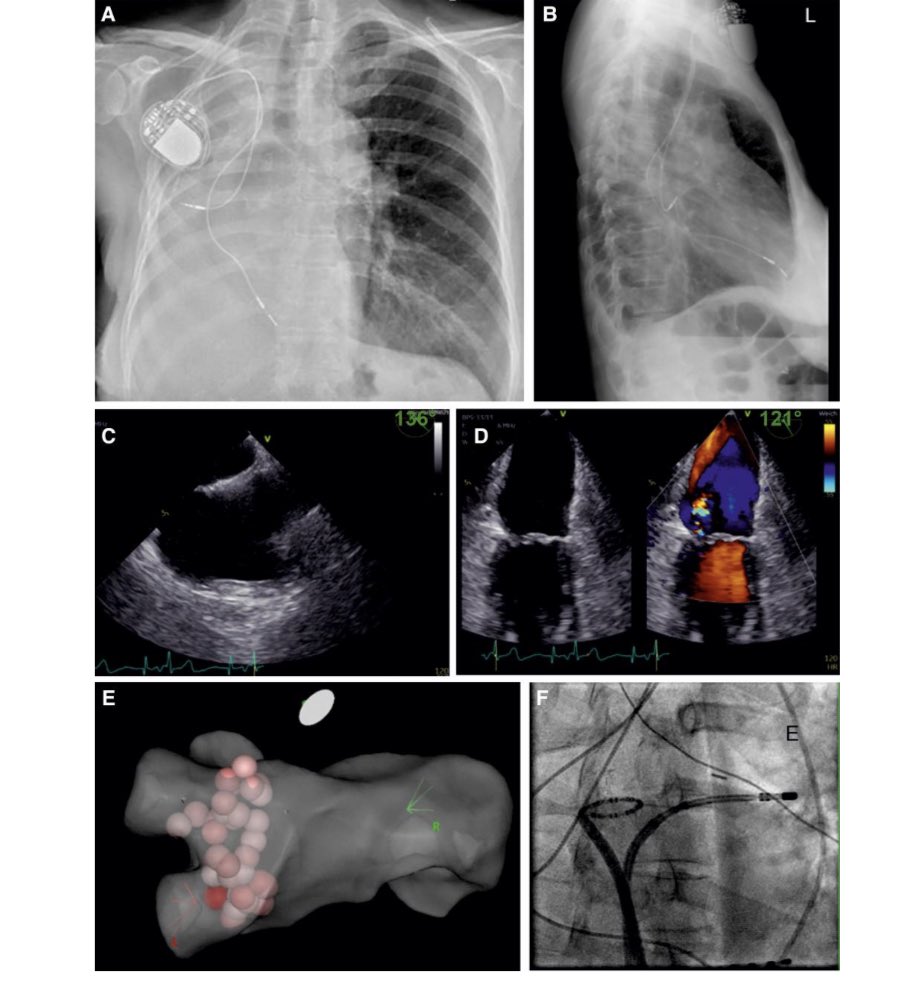 Dominik Linz tweet media