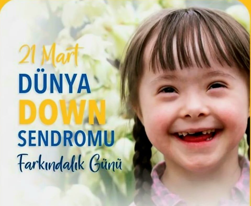 O kadar özel ve güzelsiniz ki...#DownSyndromu