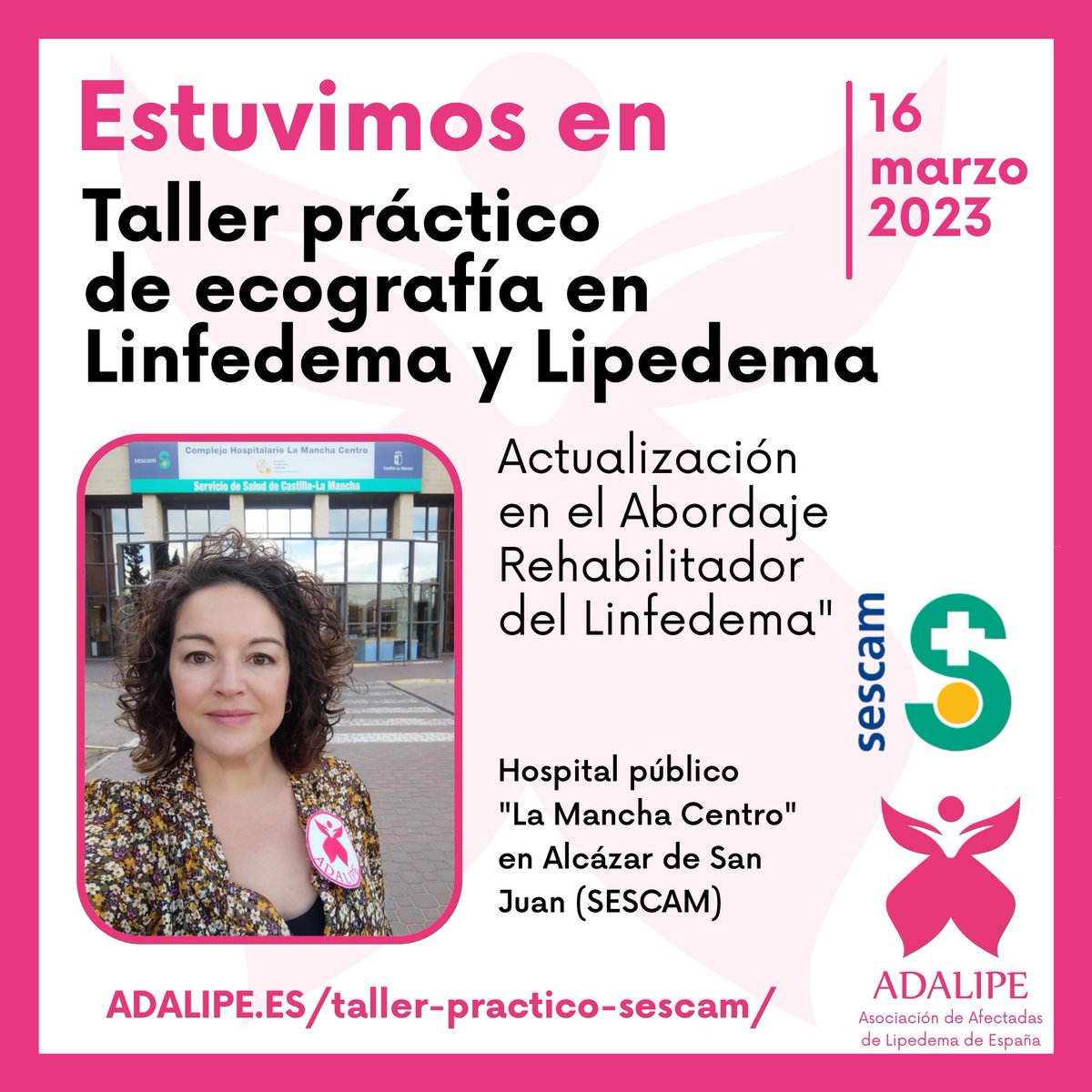 ADALIPE - asociación de lipedema de españa tweet media