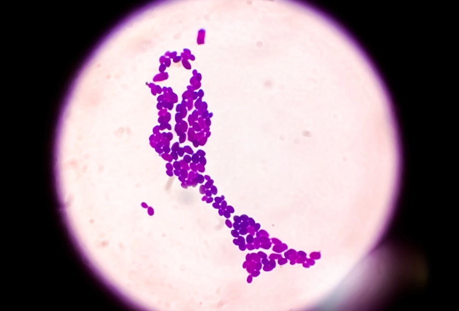 Wfla news on twitter urgent health warning rapidly spreading fungus