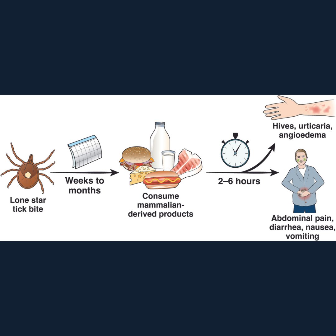 American Gastroenterological Association (AGA) (@amergastroassn) on Twitter photo #GITwitter: New CPU released to help physicians and patients understand alpha-gal syndrome, a food allergy caused by lone star tick bites. <a href="/AGA_CGH/">CGH</a> <a href="/JHashashMD/">Jana G Hashash, MD, MSc</a> <a href="/SarahMcGillMD/">Sarah McGill</a> ow.ly/WqjZ50Nom0t #GITwitter: New CPU released to help physicians and patients understand alpha-gal syndrome, a food allergy caused by lone star tick bites. <a href="/AGA_CGH/">CGH</a> <a href="/JHashashMD/">Jana G Hashash, MD, MSc</a> <a href="/SarahMcGillMD/">Sarah McGill</a> ow.ly/WqjZ50Nom0t