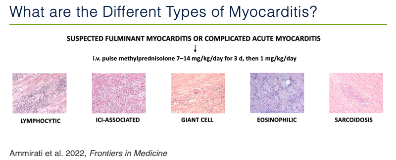 CardioOncology's tweet photo. Announcing the creation of @UCSF Myocarditis Center! Hoping to bring better mechanistic understanding of the disease to help our patients!  @DrJESalem @ImmunoCardioLab @ACCinTouch @HeartNews @NatureCVR @PilarMartinFern @CircAHA @CircRes #CardioImmunology 

https://t.co/y5QbQYeBOX https://t.co/e8PcGg7Hi2