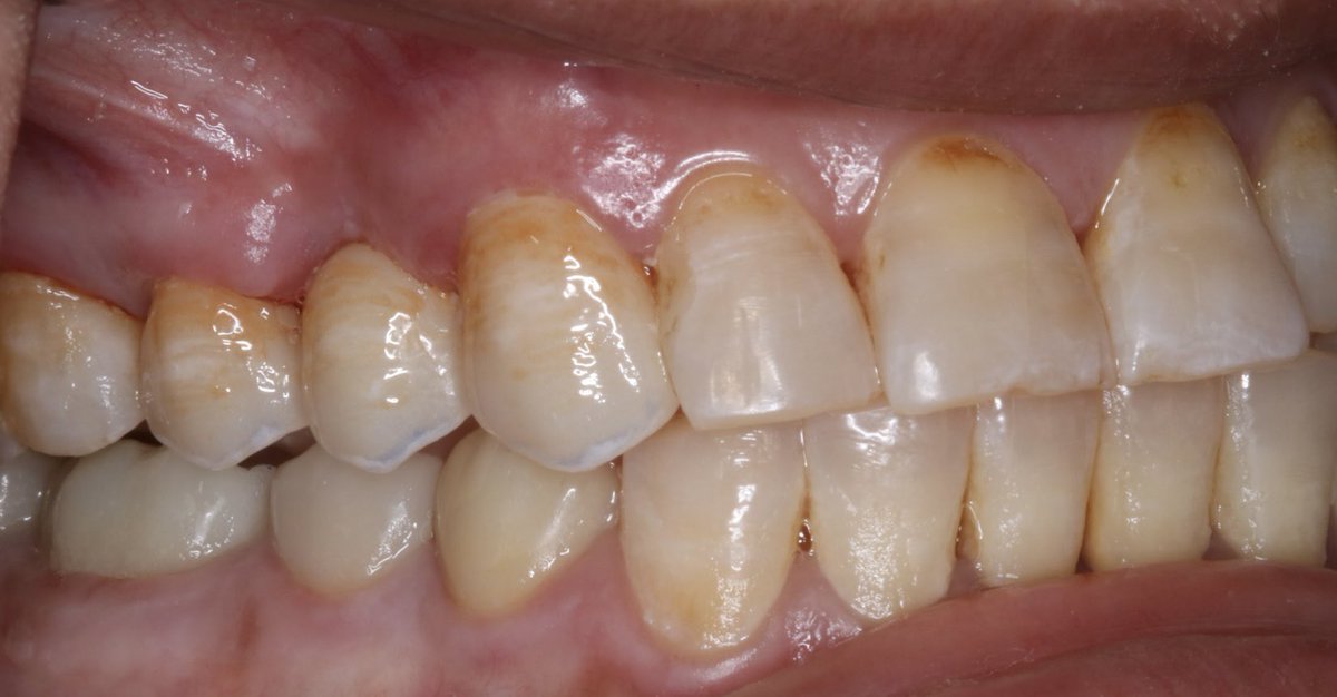 Abdulelah Alqahtani | د.عبدالاله القحطاني tweet media