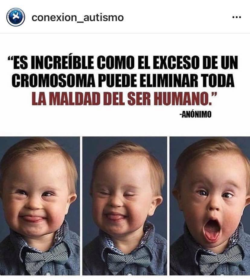 De nuestra cuenta de Instagram. 🥰💪🏼

#DíaMundialdelSíndromedeDown #21demarzo #differentnotless #uncromosomamásdeamor #rompiendomitos #diversidad #TEA #autismo #asperger #conectados