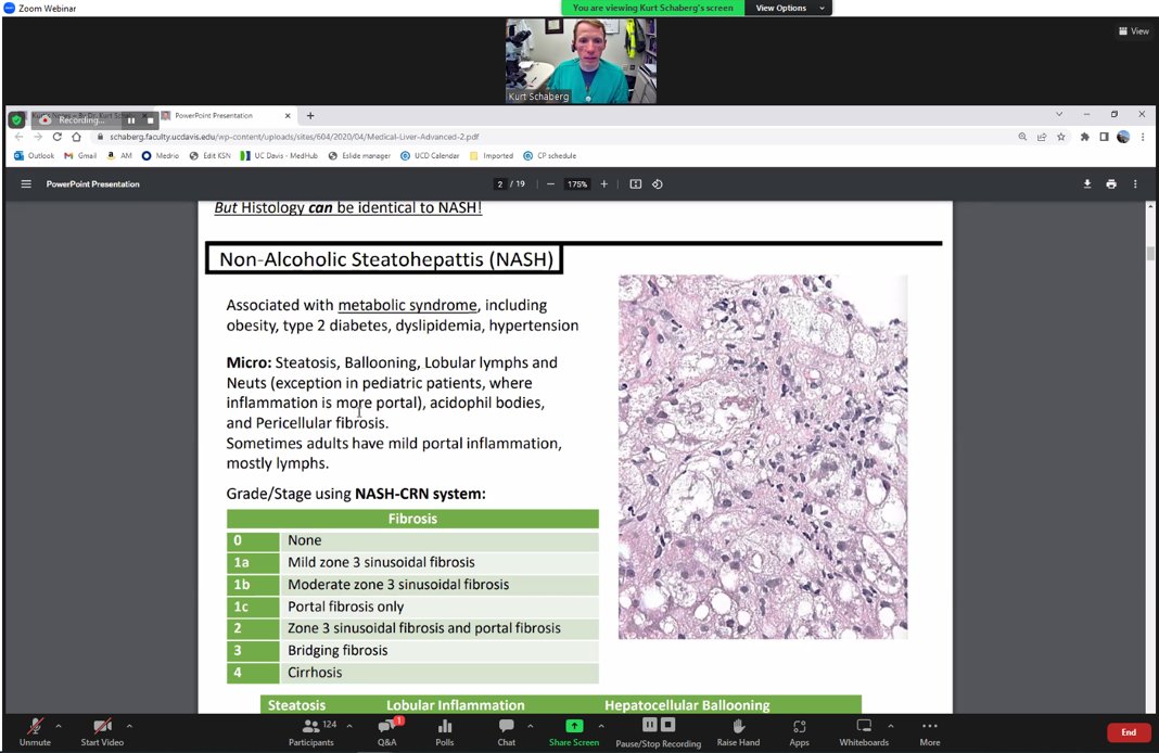 AkankshaGuptaMD's tweet photo. Don't miss the chance to learn Kurt's notes from @KurtSchaberg himself! Happening now at @AceMyPath AP/Heme course!

Join here:
https://t.co/a4CAyDdHsn https://t.co/YOoDGHDnJa