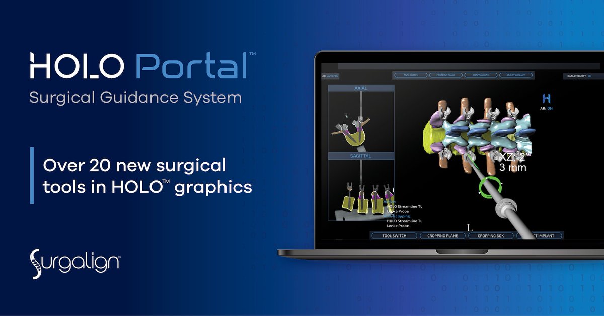surgalign's tweet photo. We’re proud to announce the launch of the #nextgen of our HOLO Portal Surgical Guidance System. The next iteration of software delivers #advancements based on early clinical experience and insights from leading #spinesurgeons in the US. Learn more at https://t.co/Sp69MUEnIe. https://t.co/iD7BYLWj1K