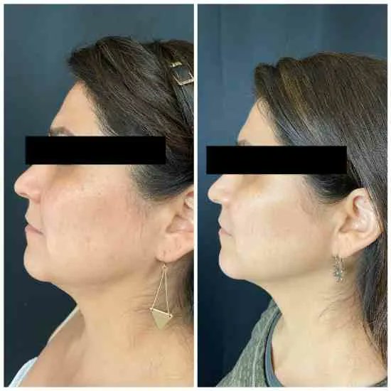 LLMSGtown's tweet photo. Let’s Talk Collagen! 
https://t.co/UFIZyqKOTH
#collagen #facial #skincare https://t.co/EepkcEMlMt