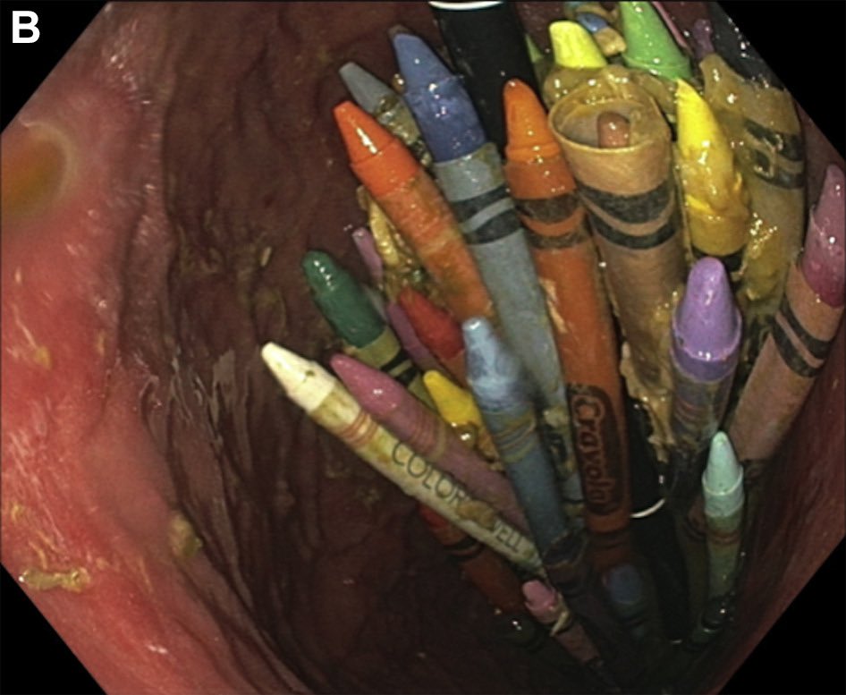 Keith Siau tweet media