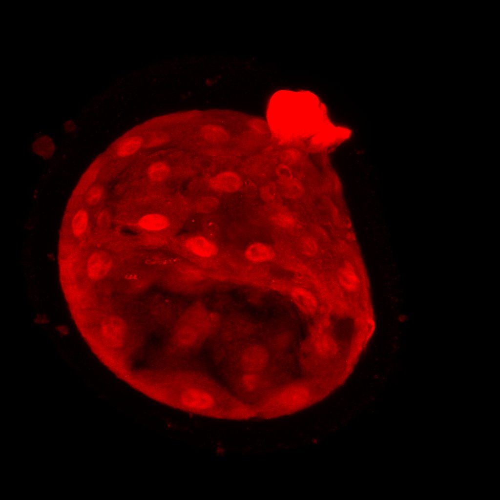 Just found out my paper on estrogen signaling in human and mouse pre-implantation embryos was accepted!!  #estrogenrules #reprorocks Figure: Estrogen receptor alpha in D5 human embryo