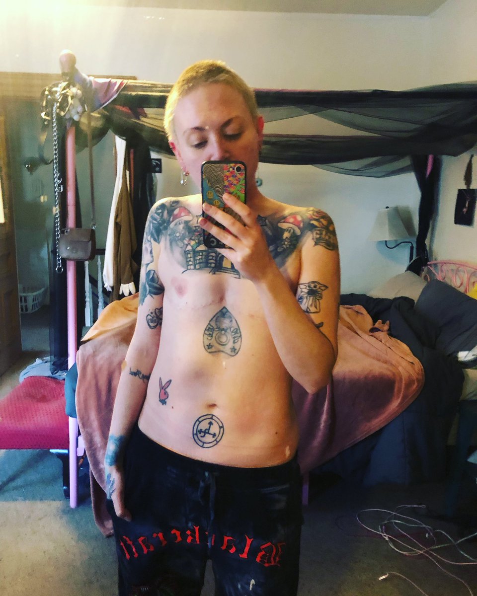 itzzShoTime's tweet photo. For years, trapped in a women’s body, I practiced self harm and disordered eating. Now, I am proud to be myself in my truest form. I often wonder who I could have flourished into if I’d have the freedom to be myself from a young age. Fight trans hate. Transitions save lives. https://t.co/5GEd6alROf