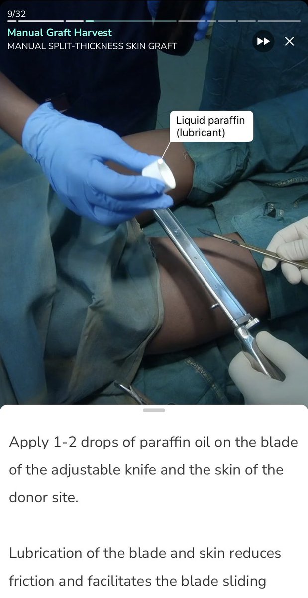 APierroMedicine's tweet photo. To any pre-med, especially pre-surgery students! Download the free app Touch Surgery, where you can participate in virtual surgery simulations. Today I learned the procedure for a skin graft! #WISE #WISE2023 @YHSMrsMero https://t.co/hCIfU32MPd