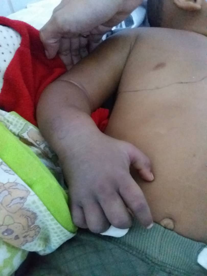 FVivarium's tweet photo. #casoenprogreso2132023Carabobo nos contactan por el accidente ofídico del niño de 1 año Angel Castillo mordido por serpiente Mapanare hoy a la 1:00am aprox. En el Pediatrico de la #Chet no hay antidotos, tiene un envenenamiento grave y requiere ser neutralizado de inmediato https://t.co/mjCQJOQBZY