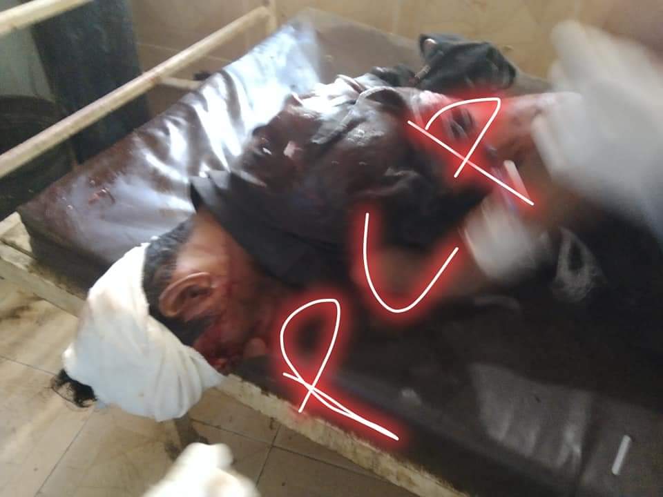 Muhamma25540176's tweet photo. پنگريو ڀرسان ڳوٺ صديق ڳاھو ۾ سنڌ ايجيوڪيشن فائونڊيشن جي ھاء اسڪول ۾ فائيرنگ ھيڊ ماستر علي حسن ڳاھو سميت 6 کان وڌيڪ شاگرد زخمي ٿيڻ جا اطلاع
تعليمي اداري تي حملو ڪرڻ بزدلي جي نشاني آهي اسڪول جي ٻارڙن تي ٿيل حملي جي سخت مذمت ڪجي ٿي 
بدين انتظاميه نوٽيس وٺي. https://t.co/KMkn4dBrgW