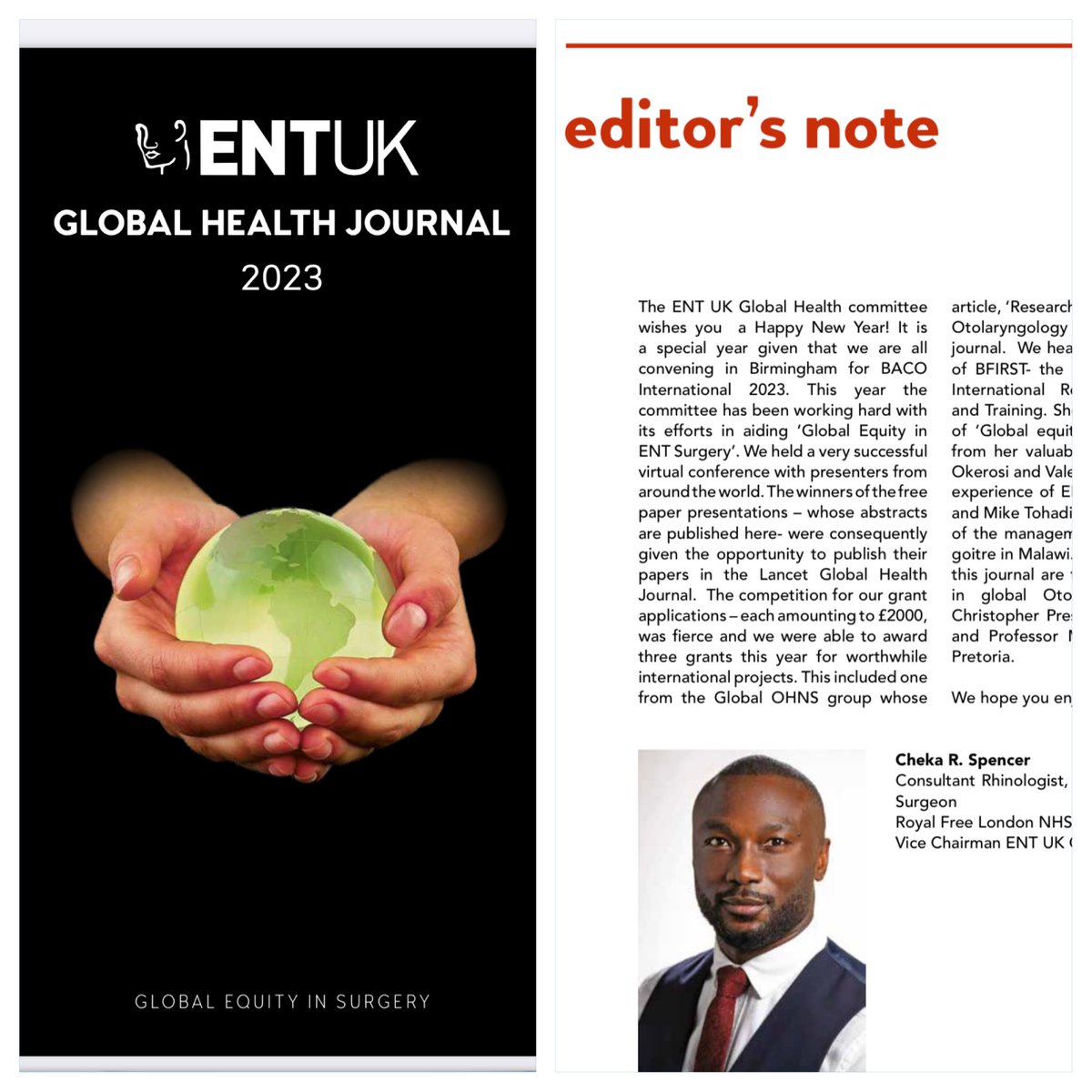 Dr Cheka R. Spencer (@drchekaspencer) on Twitter photo The <a href="/ENT_UK/">ENT UK</a> #globalhealth <a href="/ENTUKGlobal/">ENT UK Global Health</a> journal is live. Excellent contributions from <a href="/bjemec/">Barbara Jemec</a> <a href="/RolvixPatterson/">Rolvix Patterson, MD, MPH</a> <a href="/globalohns/">Global OHNS Initiative</a> etc Grateful to our industry partners <a href="/KARLSTORZUK/">KARL STORZ - UK</a> <a href="/benpattinson1/">Ben Pattinson</a> for their sponsorship. Get in touch for future collabo entuk.org/_userfiles/pag… The <a href="/ENT_UK/">ENT UK</a> #globalhealth <a href="/ENTUKGlobal/">ENT UK Global Health</a> journal is live. Excellent contributions from <a href="/bjemec/">Barbara Jemec</a> <a href="/RolvixPatterson/">Rolvix Patterson, MD, MPH</a> <a href="/globalohns/">Global OHNS Initiative</a> etc Grateful to our industry partners <a href="/KARLSTORZUK/">KARL STORZ - UK</a> <a href="/benpattinson1/">Ben Pattinson</a> for their sponsorship. Get in touch for future collabo entuk.org/_userfiles/pag…