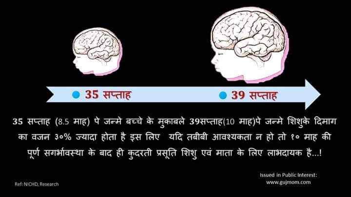 maulikdr's tweet photo. If a baby borns at 39+ weeks he/she has 30% more brain size compared to 35weeker. So elective cesareans should be at 39+weeks instead of 37weeks, if conditions permit. 
Unless indicated medically pregnancy should end naturally or continued atleast upto 40wks.
#pregnancy #baby https://t.co/Coyl80xM7V
