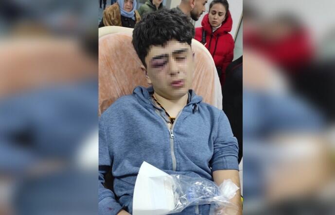 yeniyasamgazete's tweet photo. Licê’de eve dönerken polis tarafından durdurulan 14 yaşındaki bir çocuğa ‘Hizbullah yöntemleriyle’ işkence yapıldı

Y.D,  gözünü kaybetme riski yaşıyor

https://t.co/JbC7FBUsOn https://t.co/nBcPN5tvg9