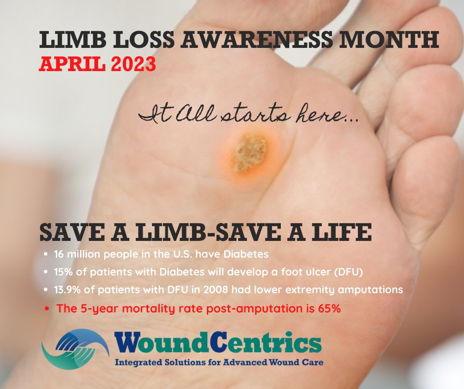 #WoundCentrics wound care specialists help save limbs and lives.
 
 #WoundCareWednesday #woundcare #woundhealing #wounds #nurses #doctors #savelimbs #diabetes #diabeticfootproblems  #patientexperience #LimbLossAwarenessMonth #LLAM #limbdifferenceawareness #LimbsAreNotALuxury