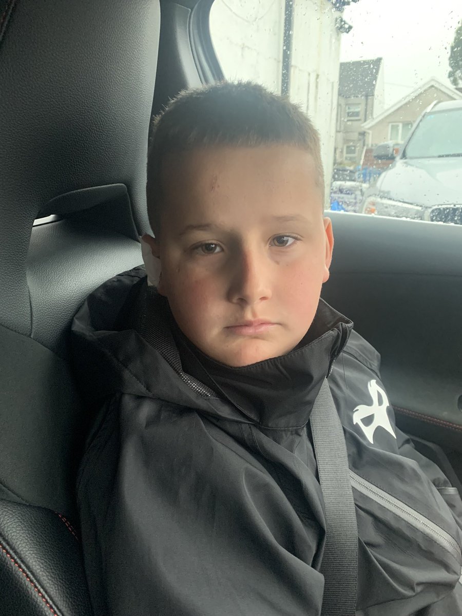 Sara John (@sarafjohn) on Twitter photo Went as <a href="/AlunWynJones/">Alun-Wyn Jones</a> to Ospreys camp today. Was it the scowl or the tape that gave it away 🤣 <a href="/CommunityOsprey/">Ospreys in the Community</a> Went as <a href="/AlunWynJones/">Alun-Wyn Jones</a> to Ospreys camp today. Was it the scowl or the tape that gave it away 🤣 <a href="/CommunityOsprey/">Ospreys in the Community</a>