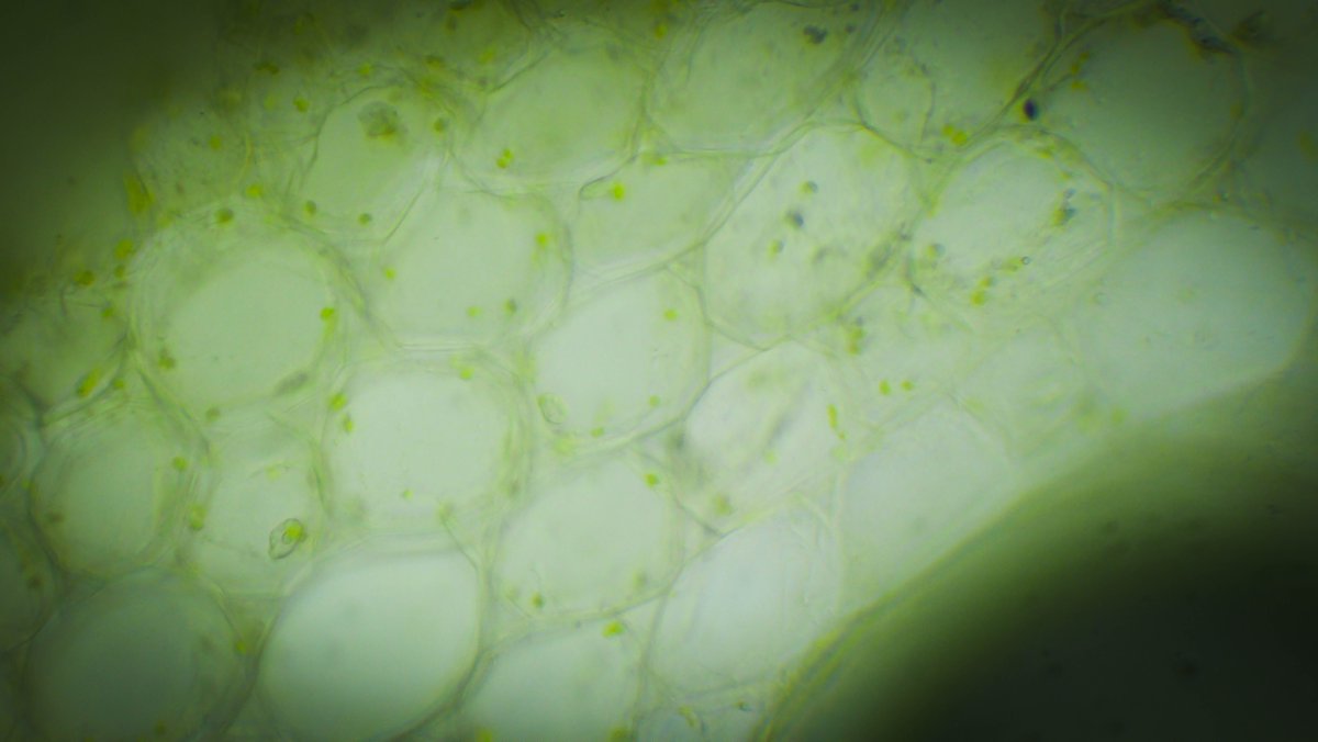 FreshGreens2Go's tweet photo. What's in a microgreen? Close up they are just cells, but they are more nutrient dense foods that their fully mature counterparts! Don't forget to eat your greens! #microscopicgreens #40xmagnification #20xmagnification#plantstemcrosssection #peamicrogreens #sunflowermicrogreens https://t.co/IY5ZbL6i1Q