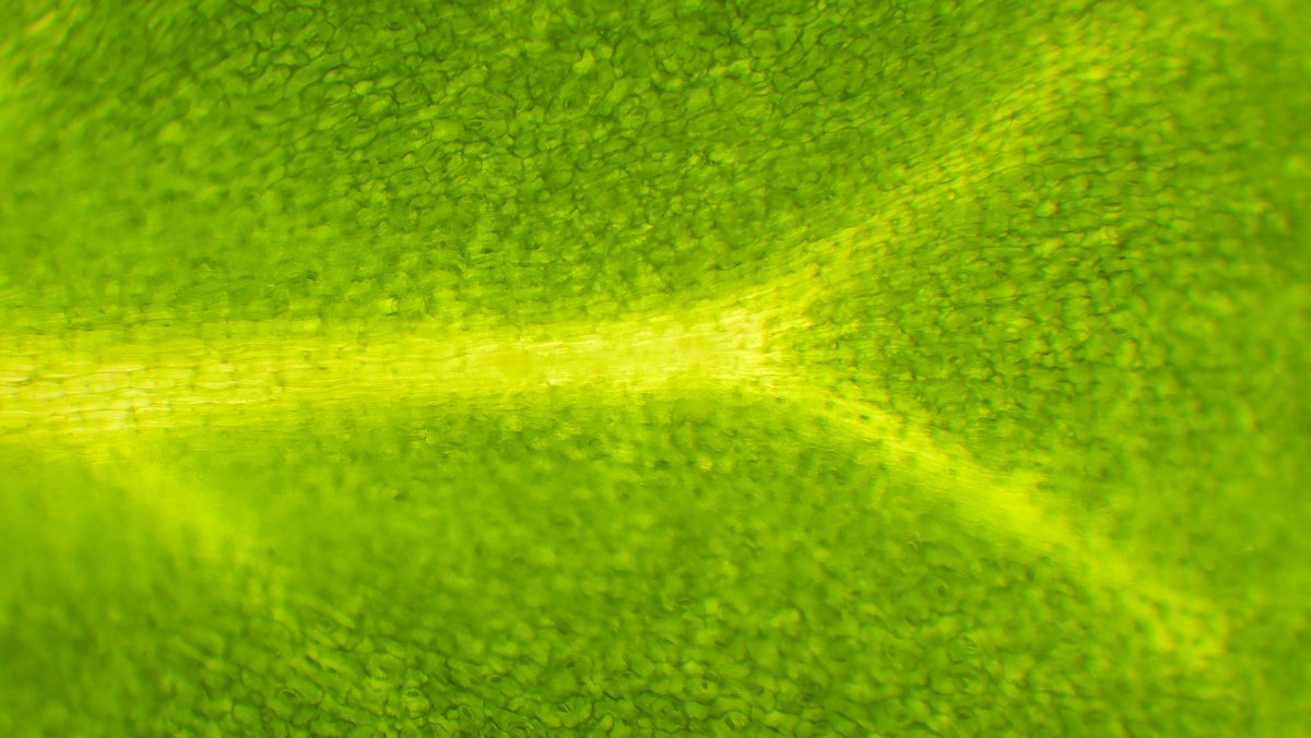 FreshGreens2Go's tweet photo. What's in a microgreen? Close up they are just cells, but they are more nutrient dense foods that their fully mature counterparts! Don't forget to eat your greens! #microscopicgreens #40xmagnification #20xmagnification#plantstemcrosssection #peamicrogreens #sunflowermicrogreens https://t.co/IY5ZbL6i1Q