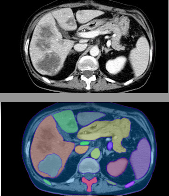 Impressive but imperfect zero-shot generalization in medical imaging for Segment Anything Model (SAM) from FAIR segment-anything.com