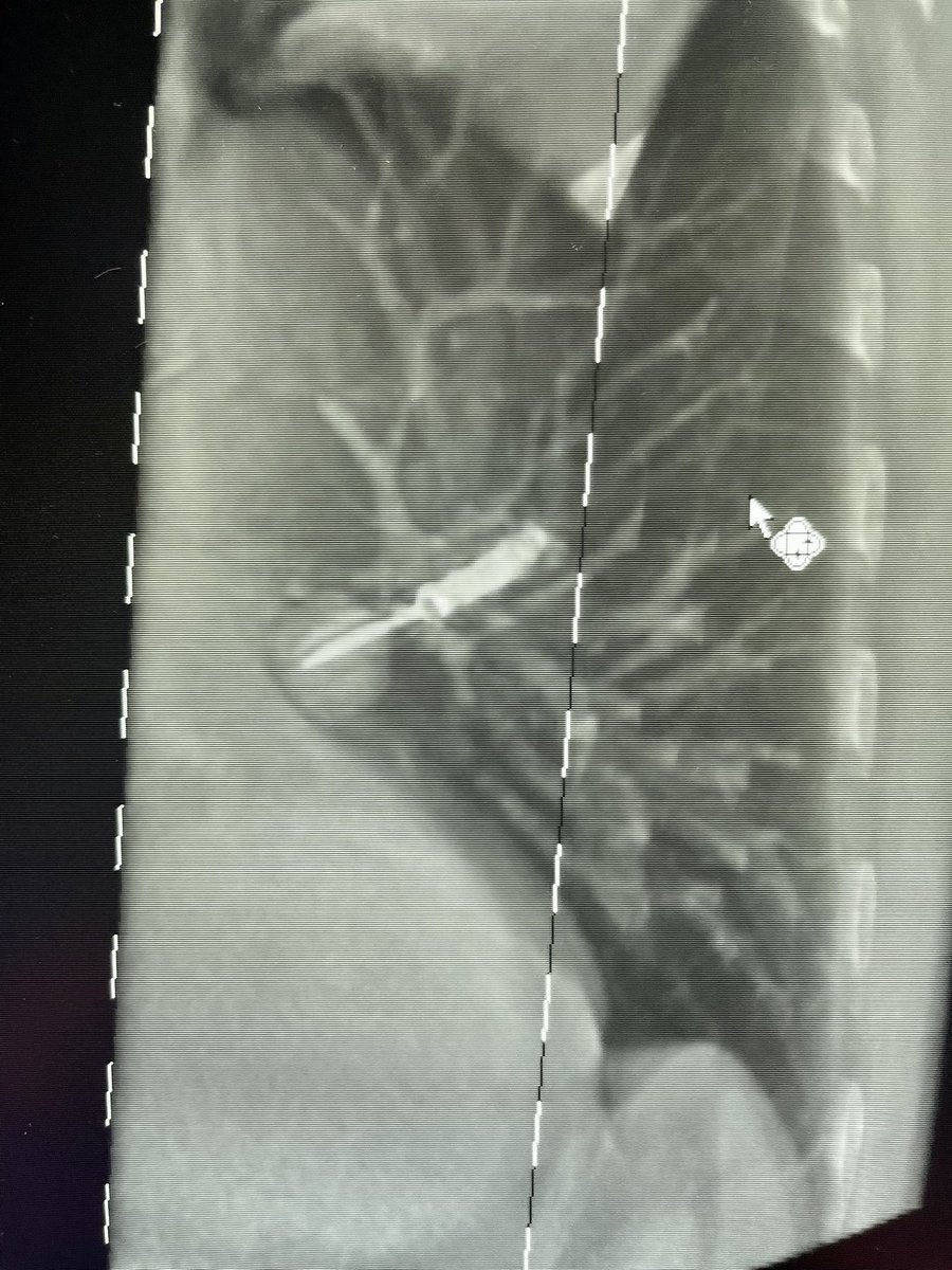 Bhadra & Condra CBCT Bronchoscopy tweet media