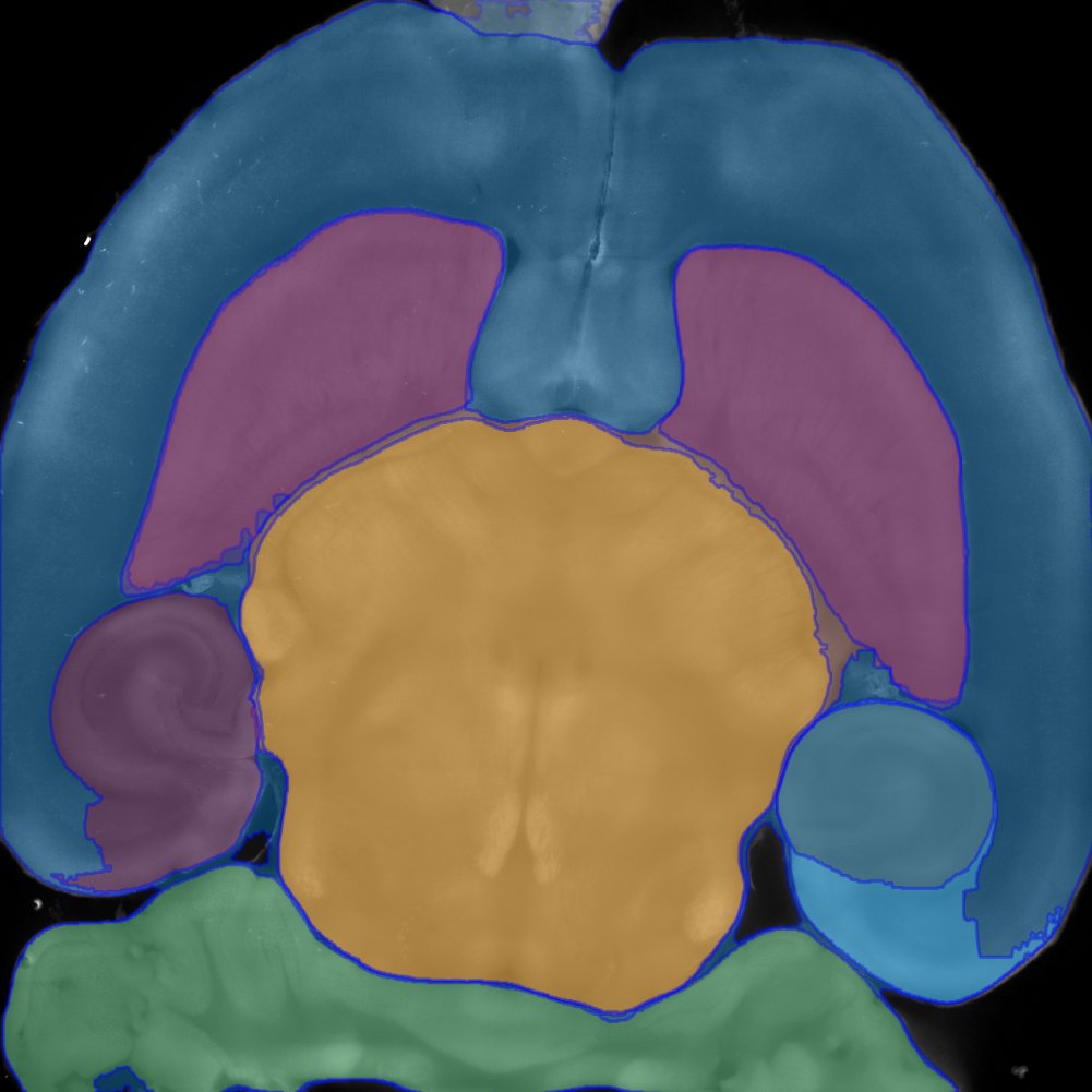 Image segmentation just got a little more cool: @MetaAI released the cure-all Segment-Anything, so let's feed it some @mesoSPIM #lightsheet #Microscopy images - it starts to pick out big brain regions - but failed on small structures - lots to learn! ai.facebook.com/blog/segment-a…