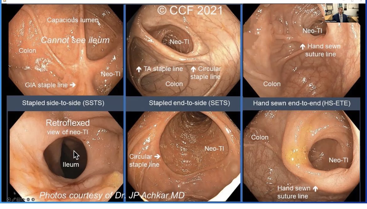 David M. Schwartzberg, MD tweet media