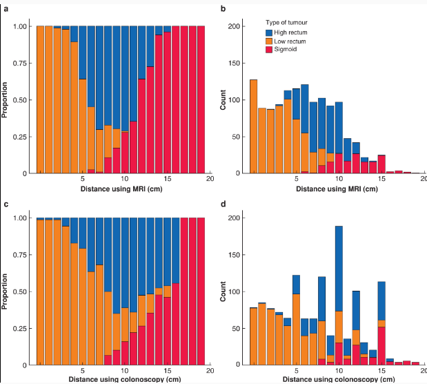 BjsOpen's tweet photo. Rectal🦀not = Sigmoid🦀‼️ Introduction of the sigmoid take-off definition in 🇳🇱 (n=1302) in retrospect resulted in 170 reclassifications Rec➡️Sigmoid &amp; 54% changes in systemic treatment!
https://t.co/hNcjZoqOnM
#some4surgery #colorectalsurgery
#StepUp4CRC @Mcfark @LauraLorenzonMD https://t.co/aTSoMSDk2z
