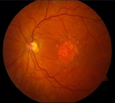 CochraneEyes tweet media