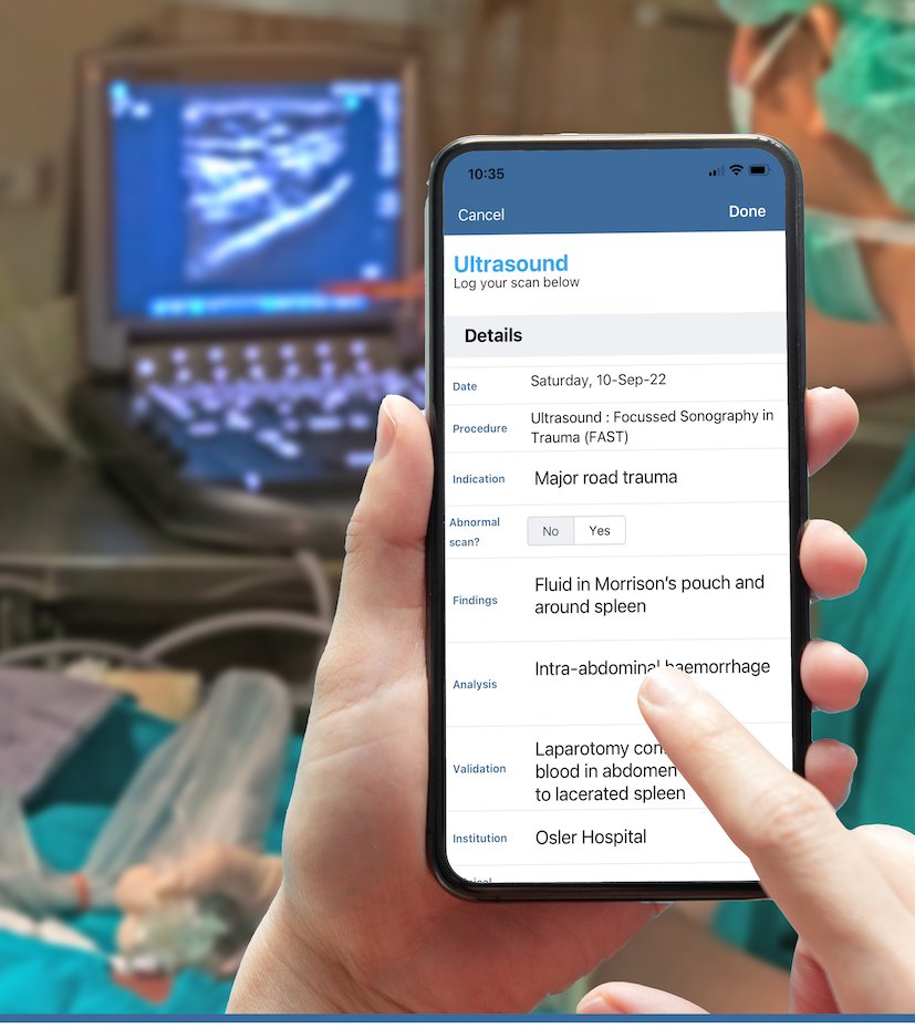 Osler_community's tweet photo. Do you perform bedside POCUS?

Capture all your scan in one place with Osler

https://t.co/dheC5MCSCT

#POCUS #FOAMpocus #medtwitter #medstudenttwitter #juniordoctors #ICU #intensivist #emergencymedicine #emergencyphysician #FOAMed #FOAMcc https://t.co/IT4GvLI4Q9