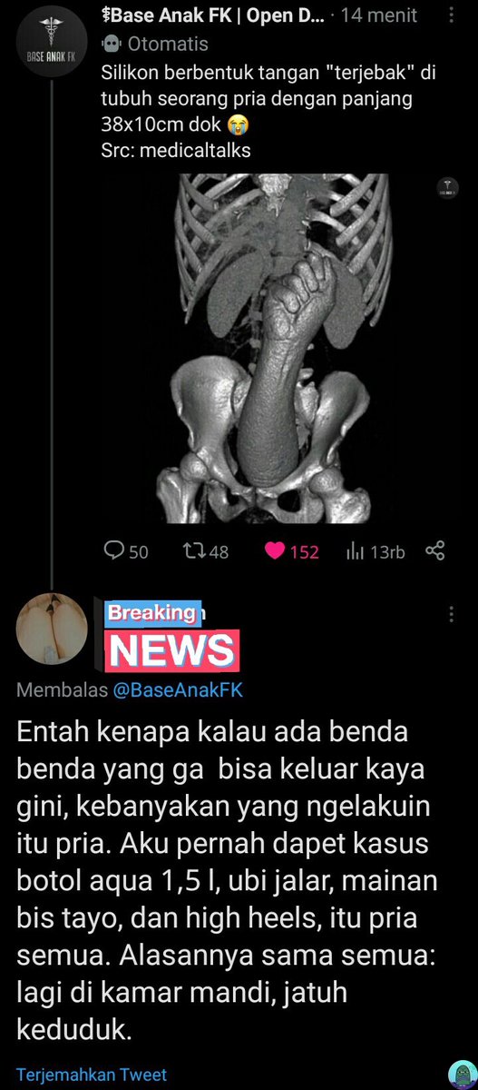 tanyakanrl's tweet photo. 💚 tw // disgusting

spicles bgt...... emg bisa gitu yaa? https://t.co/vbxupovH66