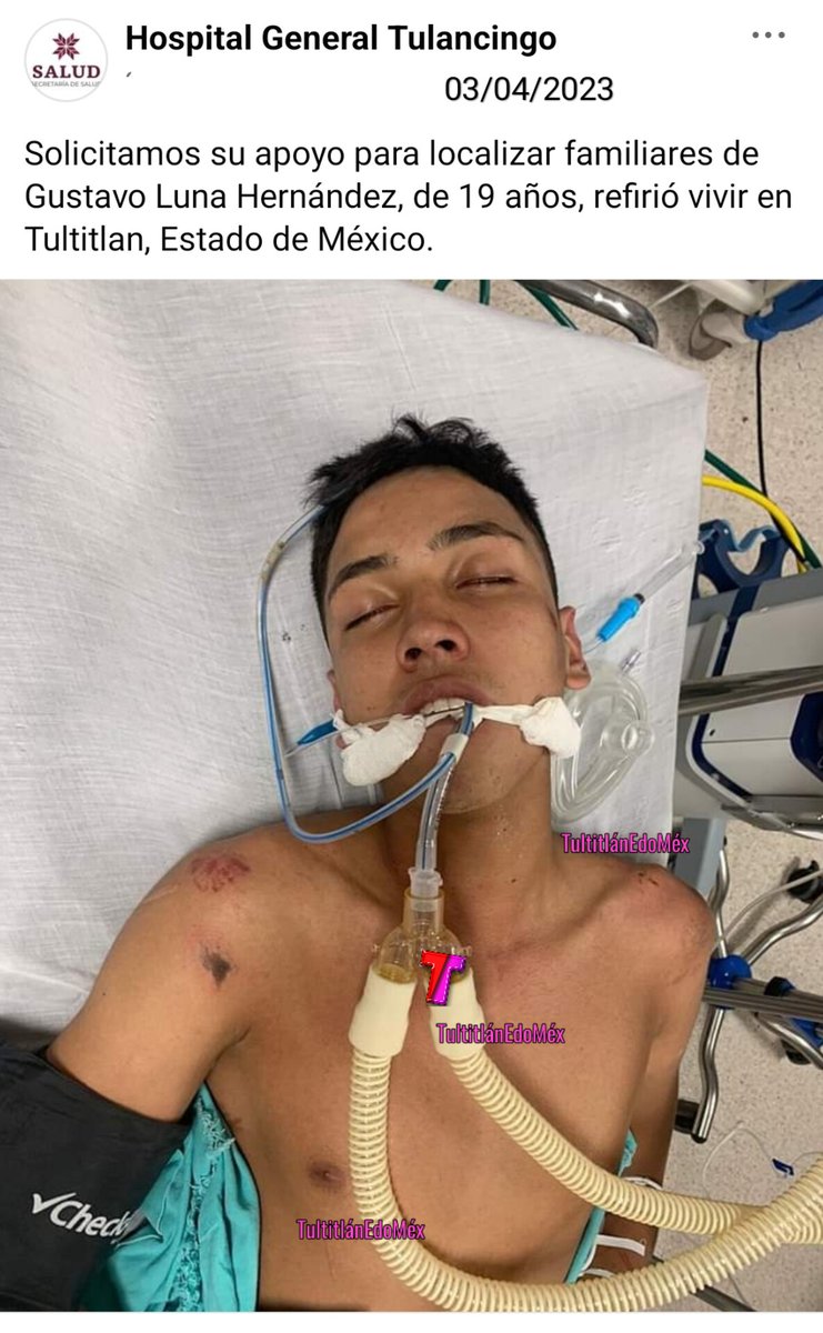 El Hospital General Tulancingo solicita el apoyo para localizar a familiares de Gustavo Luna Hernández de 19 años, refirió vivir en #Tultitlán, Estado de México. Por favor comunicarse directamente al Hospital. ⚠️ #ATENCIÓN La fecha de publicación 03/04/2023