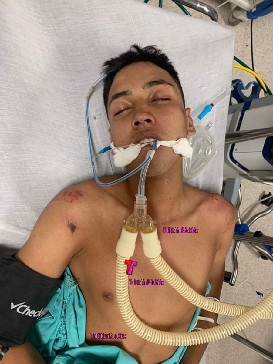 tultitlanEdoMex's tweet photo. El Hospital General Tulancingo solicita el apoyo para localizar a familiares de Gustavo Luna Hernández de 19 años, refirió vivir en #Tultitlán, Estado de México. Por favor comunicarse directamente al Hospital. ⚠️ #ATENCIÓN La fecha de publicación 03/04/2023 https://t.co/1MEKPohiAx