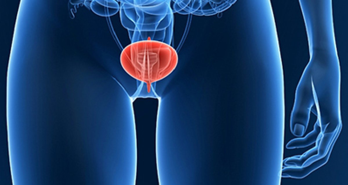 Water helps clear out harmful things like bacteria and may help prevent bladder cancer by flushing out certain chemicals. If you don't drink enough, your urine will have less water in it, and that can irritate your bladder. wb.md/3G2AaGz