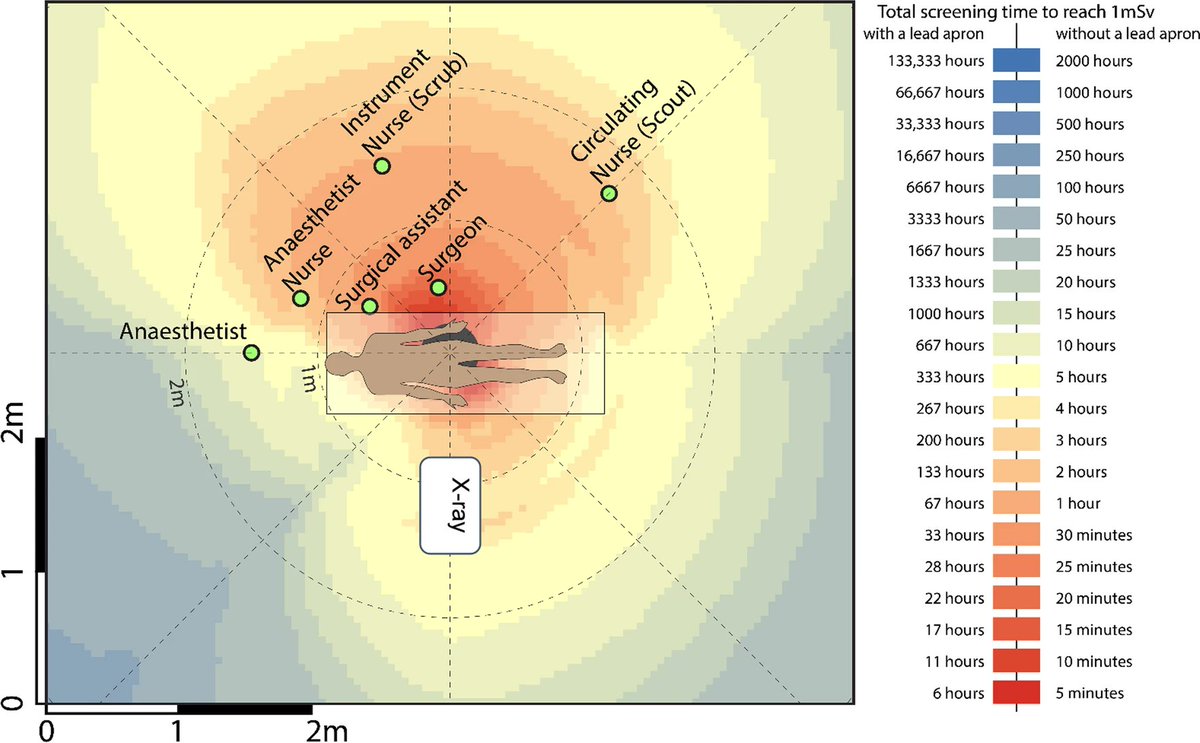 Surgeons, nurses & radiographers... Have you ever been in theatre, wondering how much radiation dose you were getting? Our latest publication displays radiation 'heatmaps' for some common ortho surgeries. The open-access paper is here: pubmed.ncbi.nlm.nih.gov/37004602/ @SpringerNature