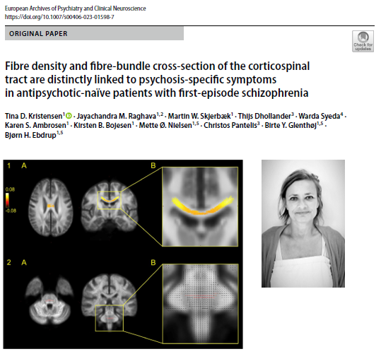 CNSR_cph's tweet photo. New paper from @TinaDamK et al. using fixel-based analysis to examine links between white matter and psychosis-specific symptoms in antipsychotic-naïve patients with first-episode schizophrenia. 

Full paper available here: https://t.co/V300N5vjqf https://t.co/dGEqxqGwRJ