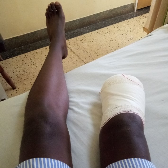 Goddie_Ke's tweet photo. How long should an insurance claim last? His name is Joseph Kamanja. He was hit by a vehicle insured under Amaco insurance in 2014. A judgement on compensation he was supposed to receive was passed in 2018. It's been over 5years and @Amaco_Ltd wamekua wakizungusha the family... https://t.co/vduPlzSTJO