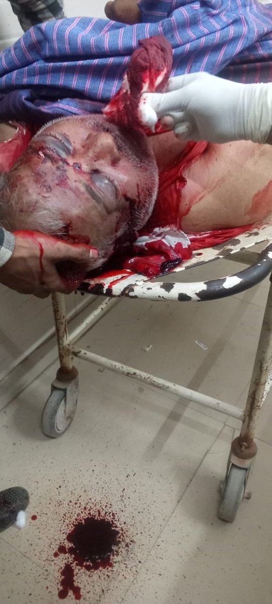 <a href="/ArvindKejriwal/">Arvind Kejriwal</a> ji today due to negligence of <a href="/DelhiJalBoard/">Delhi Jal Board</a> maintenance unit we have lost a loved one in #BharatCity on Pipeline road Tila Mod, GZB, UP. Despite many requests the Unit has failed to install speed breakers on recently laid road. #DelhiJalBoard is responsible