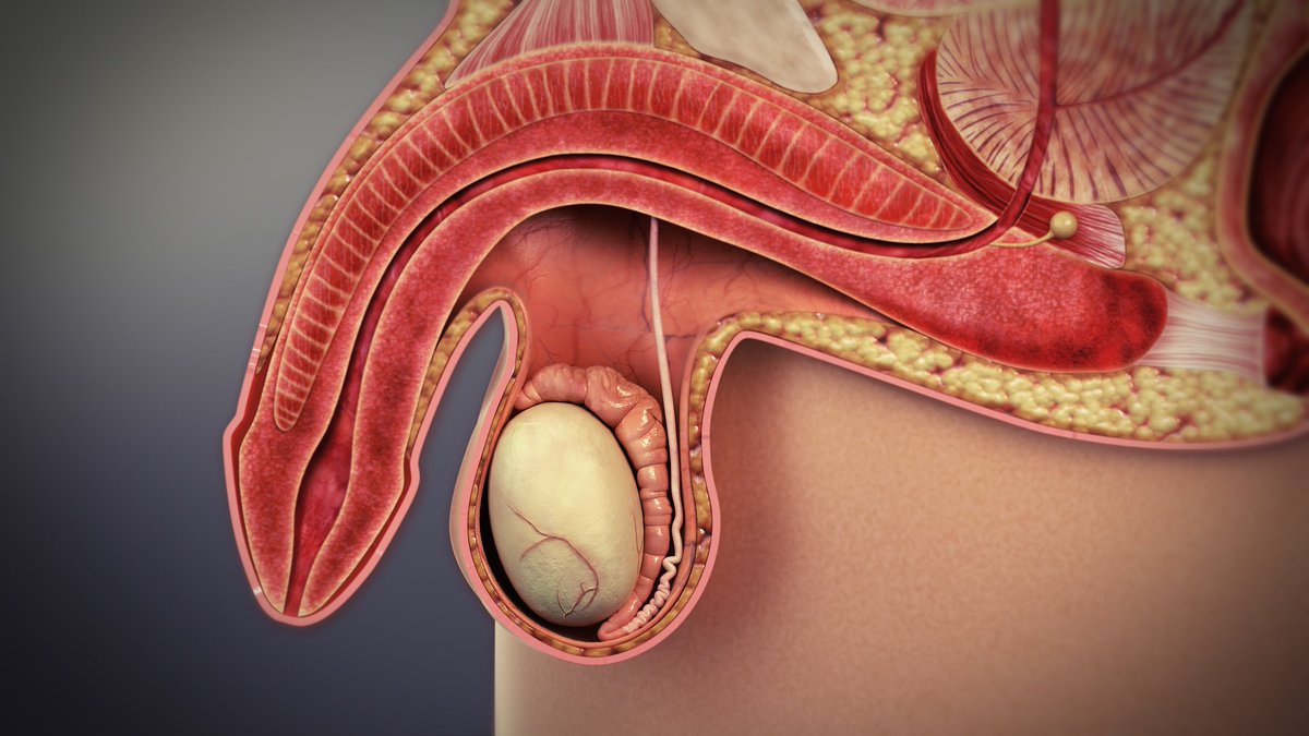 _elvis_simons's tweet photo. Impotency or erectile dysfunction is one of the biggest sexual problems affecting young men these days.

This problem has been affecting their lives, relationships or marriages and making life very depressing for them.

Read more about the causes and the treatments; https://t.co/sU6P9LxIps