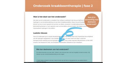 Hy2Care has started with the 2nd phase of its #clinicalstudy enabling optimal #cartilagerepair in the knee. This year, 36 patients can be treated with the CartRevive™ hydrogel implant. Read more about the criteria to participate in the study: bit.ly/40ob25k