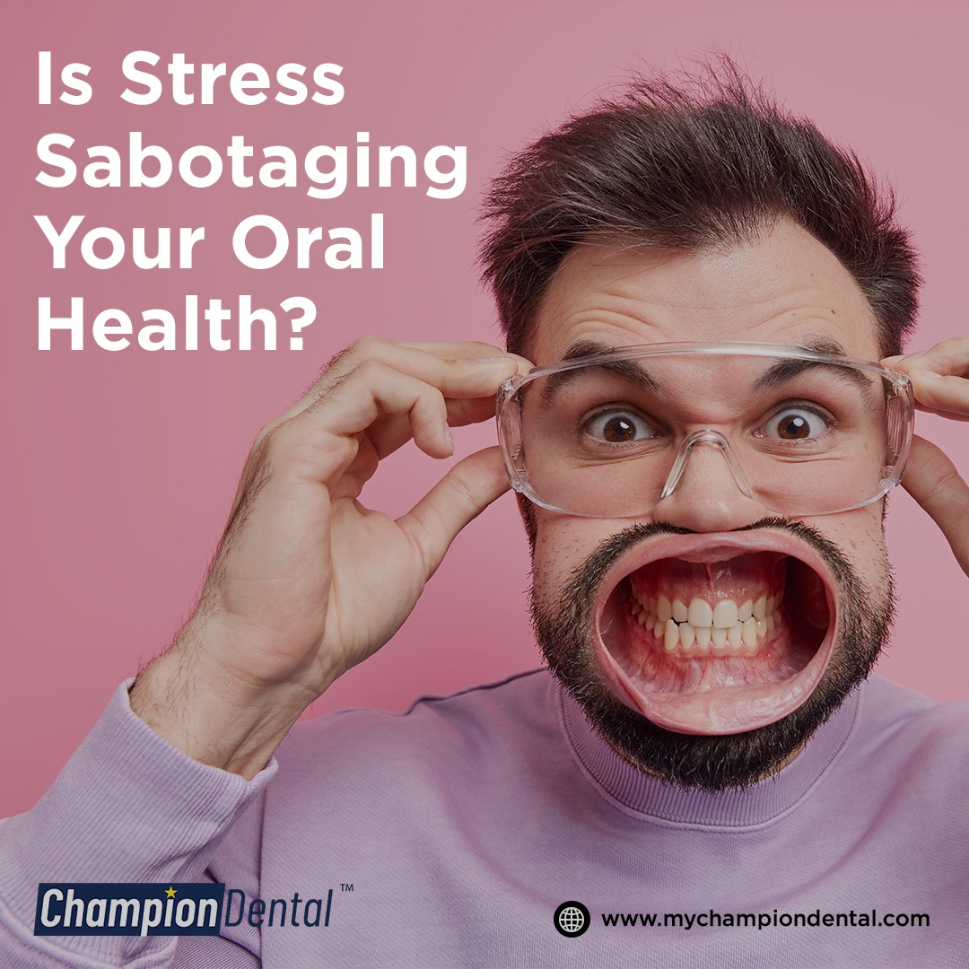 #Stress can affect your #OralHealth in many ways,
Bleeding gums & #badbreath
#Drymouth, #Teethgrinding #mouthulcers
Muscle pain due to clenching
#Farmersbranchtx Call 214-747-0763 for a  #dentalconsultation

#dfwtx #championdentaltx #fbtx #farmersbranchtexas  #fbtxdentist