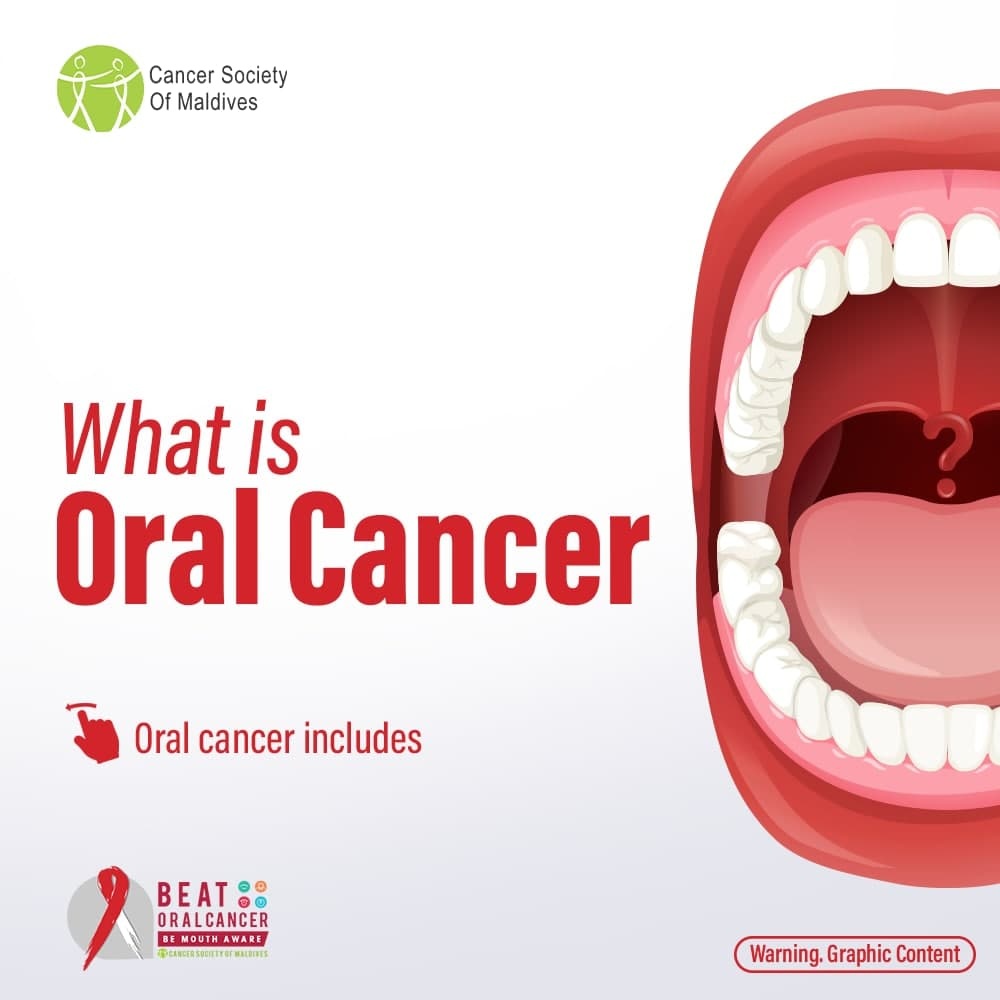 CancerSocietyMV's tweet photo. Oral cancer can develop in most parts of the mouth, including the lips, sinuses, throat, tongue and floor of the mouth.

#BeatOralCancer https://t.co/qSVgVktpxW