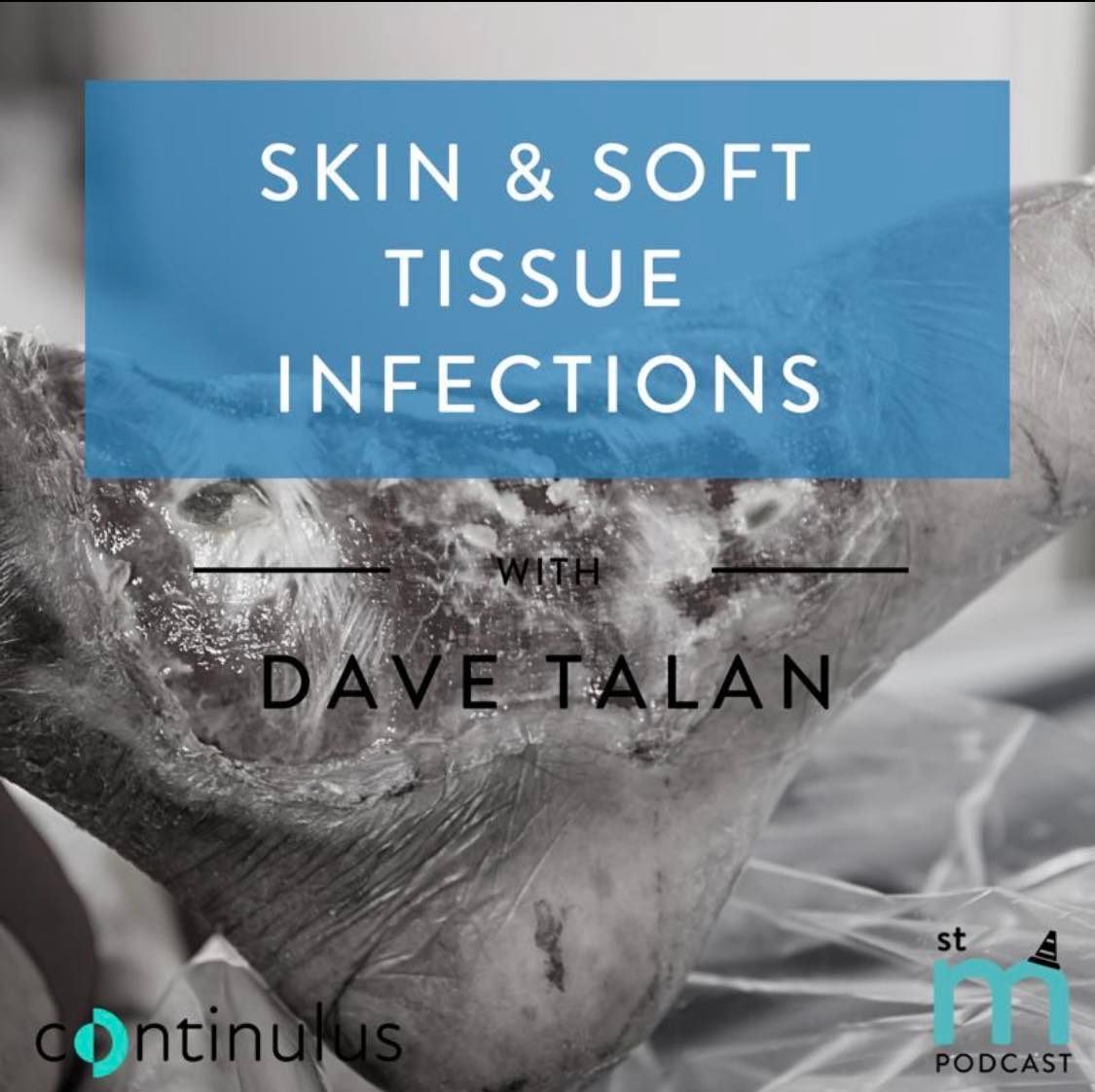 🔥 Listen to the new St Mungos podcast! Dave Talan: 'Skin and Soft Tissue Infections'👀 🔗 stmungos-ed.com/podcast/dave-t… @DavidTalanMD @continulus #FOAMed #skin #ED