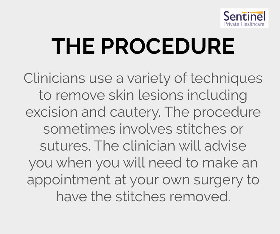 Sentinel_PHCare's tweet photo. "Say goodbye to unwanted skin lesions with our safe and effective removal procedures. Don't let skin lesions affect your confidence - our expert team can remove them quickly and efficiently." @Sentinel_PHCare @Sentinel_CiC
.
.
.
#SkinLesionRemoval
#ByeByeLesions
#LesionFree https://t.co/dxbu4GXIKg