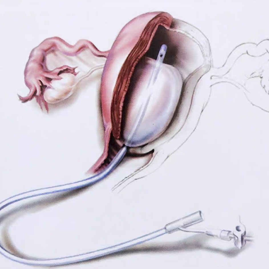 穴宫巢管 tweet media