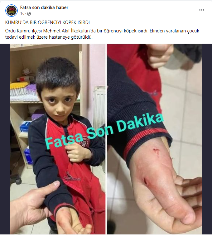 _ErcanOzcelik's tweet image. Sokak, okul, park, orman, yurdumuzun her yerini işgal eden #BaşıboşKöpekler en sonunda sizlerin evladınızı veya torununuzu ısırdığında mı bu teröre dur diyeceksiniz?
Üstelik her mağdur bu kadar ucuz kurtulamıyor!
@RTErdogan @suleymansoylu @VahitKirisci @Akparti @rprefahpartisi